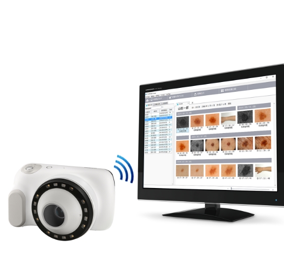 皮膚観察・撮影用デジタルカメラ ダーモカメラ